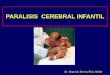 PARALISIS CEREBRAL INFANTIL · b- Parálisis Cerebral Disquinética ó Distónica 20 % • Hay afectación del sistema extrapiramidal. • Núcleos de base y conexiones: caudado,putamen,
