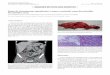 Debut de cistoadenoma apendicular y tumor carcinoide como …scielo.isciii.es/pdf/diges/v109n2/es_imagenes2.pdf · 2017-06-12 · IMÁGENES EN PATOLOGÍA DIGESTIVA Debut de cistoadenoma