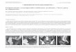 Endometriosis rectosigmoidea infiltrante profunda. Claves ...scielo.isciii.es/pdf/diges/v106n3/es_imagen1.pdf · La endometriosis se define como la presencia de tejido endometrial