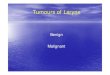 Benign Malignant - GMCH lectures/ENT/Tumours of Larynx (2).pdf Carcinoma Larynx • Occurs in every country in the world • 2.3% of all malignant male tumors & 0.4% of female •