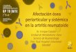 Afectaciónósea periarticular y sistémica en la artritis reumatoide · 2018-12-20 · Afectaciónósea periarticular y sistémica en la artritis reumatoide Dr. Enrique Casado Unidad