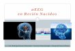 aEEG en Recién Nacidos - Neo Puerto Montt [Modo de... · 2018-09-26 · aEEG v/s EEG A diferencia del EEG convencional requiere sólo 1 o 2 canales lo que hace más fácil su manejo