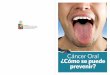 UNIVER C … · Cáncer de labios y cavidad oral ¿Cómo se puede prevenir? Evita fumar Evita el consumo de alcohol Mantén una buena higiene oral Protege tus labios con filtro solar