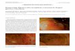 Hemorragia digestiva alta secundaria a sarcoma de Kaposi ...scielo.isciii.es/pdf/diges/v104n1/es_imagenes1.pdf · IMÁGENES EN PATOLOGÍA DIGESTIVA Fig. 2. Lesiones papulares violáceas