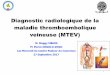 diagnostic radiologique de la MTEV- Pasteur · La maladie thrombo-embolique veineuse au Cameroun (A propos de 18 cas). Med Trop 2002. 2002;62:47-50 • Owono Etoundi P, Esiene A,