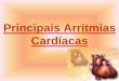 Principais Arritmias Cardíacas 19... · •Chamamos de arritmias cardíacas toda alteração na condução elétrica do coração, alterações em eletrólitos, equilíbrio ácido-base