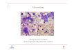 Föreläsning hematologi primärvård 2017 PC pptx¤t/Vårdgivare...Hematologi Mattias Mattsson, överläkare Blodmottagningen/50C Akademiska sjukhuset Benign hematologi Anemier –