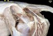 ºzAnatomía Veterinaria UAB · Vista lateral izquierda de la parte caudal de la pared abdominal, de la región glútea y de la parte proximal del muslo. La resección de los músculos