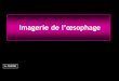 Imagerie de l’œsophage - ONCLE PAULonclepaul.fr/wp-content/uploads/2011/07/oesohage...l'estomac • Tube musculaire de 25 cm de longueur • De C6 à T11 • Du constricteur inférieur