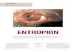 Normalt öga. Entropion - Svenska Kennelklubben · förklara hur fyra olika typer av entropion uppkommer. Entropion hos shar pei, som orsakas av mucinos, behandlas inte här. Entropion