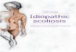 Uitnodiging - Erasmus University Rotterdam Eveline Margaretha.pdf · Uitnodiging voor het bijwonen van de openbare verdediging van mijn proefschrift Idiopathic scoliosis: evaluation