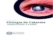 E-book Cirurgia de Catarata - Tradicional x Laserdrrodrigosalustiano.com.br/files/E-book Cirurgia de Catarata... · A cirurgia de catarata a laser fornece os mesmos resultados que