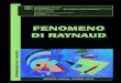 FENOMENO DI RAYNAUD · 2 Fenomeno di Raynaud DESCRIZIONE Nel 1862, Auguste-Maurice Raynaud descrisse per la prima volta il cambiamento di colore delle dita, scatenato dall’esposizione