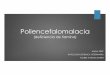 Poliencefalomalacia - WordPress.com€¦ · Patología Se producen una serie de enzimas (t iaminasas) que van a ser capaces por un lado de producir una elevada toxicidad (t iaminasas