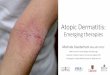 Atopic Dermatitis - Dermatology Updatedermatologyupdate.com/docs/pdf/2017/Melinda-Gooderham-Atopic … · aP