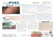 Onicomicosis - SEMG · Publicación para la formación dermatológica en Atención Primaria Volumen 1 -Número 1 junio 2020 EDITORIAL Dr. Rafael Sánchez Neoplasia cutánea (Pilomatrixoma)