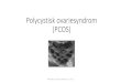 Polycystisk ovariesyndrom (PCOS) · Stein-Leventhal Syndrom, 1935 Stein and Leventhal, ... West et al., 2014. Patogenese ved PCOS Mette Petri Lauritsen, Hvidovre, d. 1.11.19. The