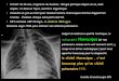 radiographie thoracique (et nononclepaul.fr/wp-content/uploads/2011/07/spotu1.pdf · thoracique (et non pulmonaire comme on le voit souvent écrit, y compris en milieu radiologique