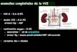 anomalies congénitales de la VCI - ONCLE PAULonclepaul.fr/wp-content/uploads/2011/07/pathologie-VCI...malformations abdominales associées à la polysplénie isomérisme hépatique,agénésie