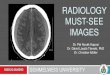 RADIOLOGY MUST-SEE IMAGES - Semmelweis Egyetem · Region: Brust, Achsel Radiologisches Zeichen: linkes Bild - gut definierte anechoische Läsionmit posteriorer akustischer Verstärkung;