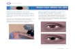 Gotas para dilatar los ojos - San Antonio Eye Center · 2020. 8. 6. · Los efectos de las gotas para dilatar los ojos duran algunas horas. Su oftalm61ogo no puede determinar la medida