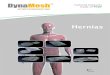 Hernias · 2020. 12. 16. · Hernias. Tailored Implants made of PVDF. by FEG Textiltechnik mbH. 2. Visceral Surgery. Pie de imprenta. ©FEG Textiltechnik mbH Aachen, Alemania Realización:
