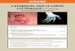 L’essentieL sur Le Lupus systémique (1re partie)