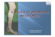 VARIZES DE MEMBROS INFERIORES - Campinas-SP