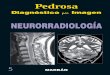 Pedrosa 5 Neurorradiologia.pdf, page 1 @ HotFolder 