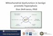 Mitochondrial dysfunction in benign prostatic hyperplasia 