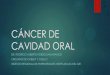CANCER DE CAVIDAD ORAL - irensur.gob.pe