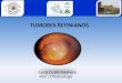 061 Tumores retinianos