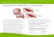 Hematomas epidurales y subdurales - Intermountain Healthcare