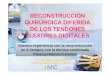 RECONSTRUCCIÓN QUIRÚRGICA DIFERIDA DE LOS TENDONES 